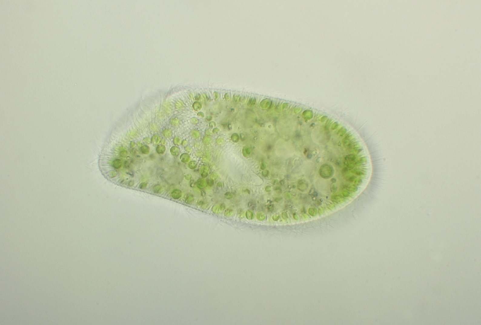 Paramecium Bursaria